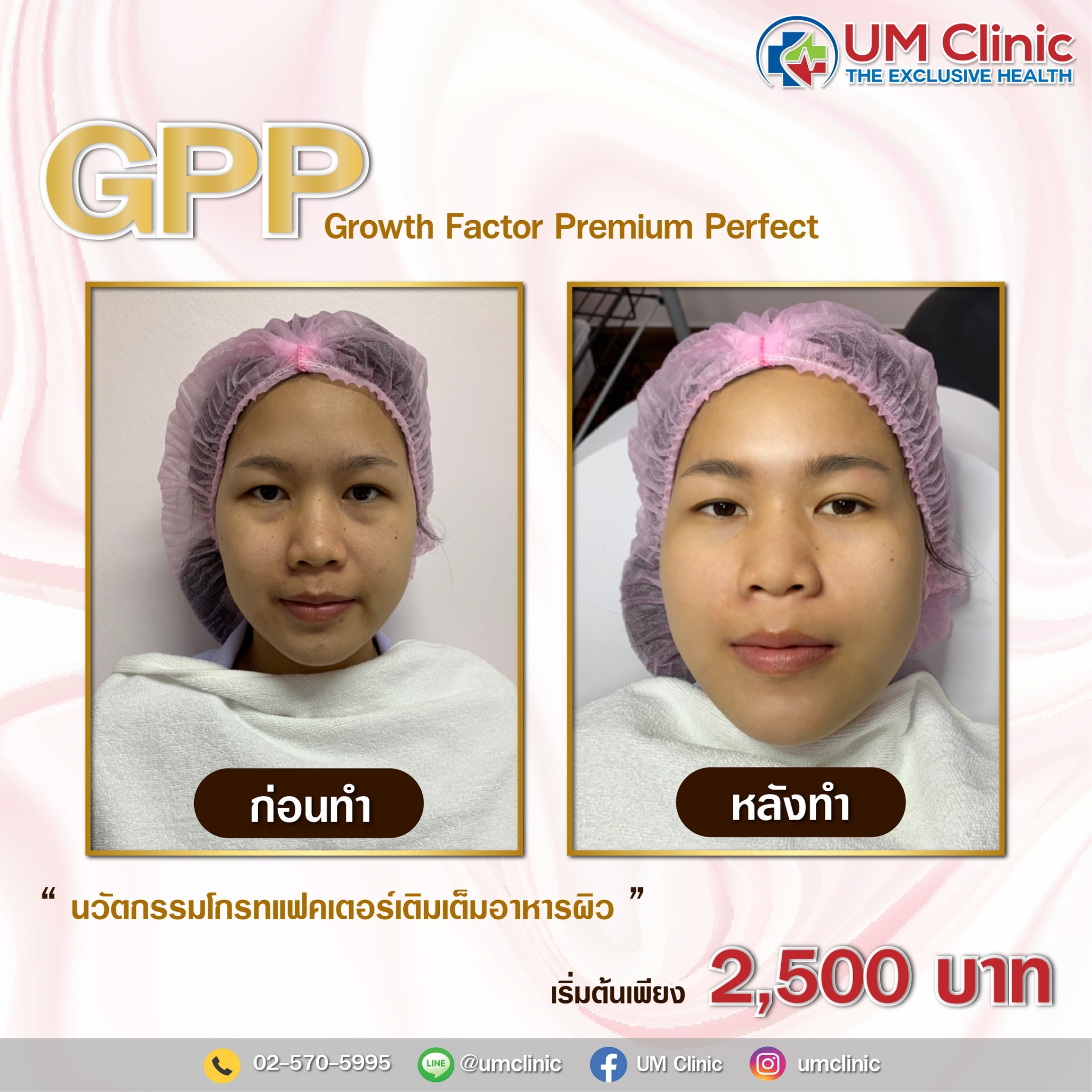 GPP_๒๑๐๓๐๑_0