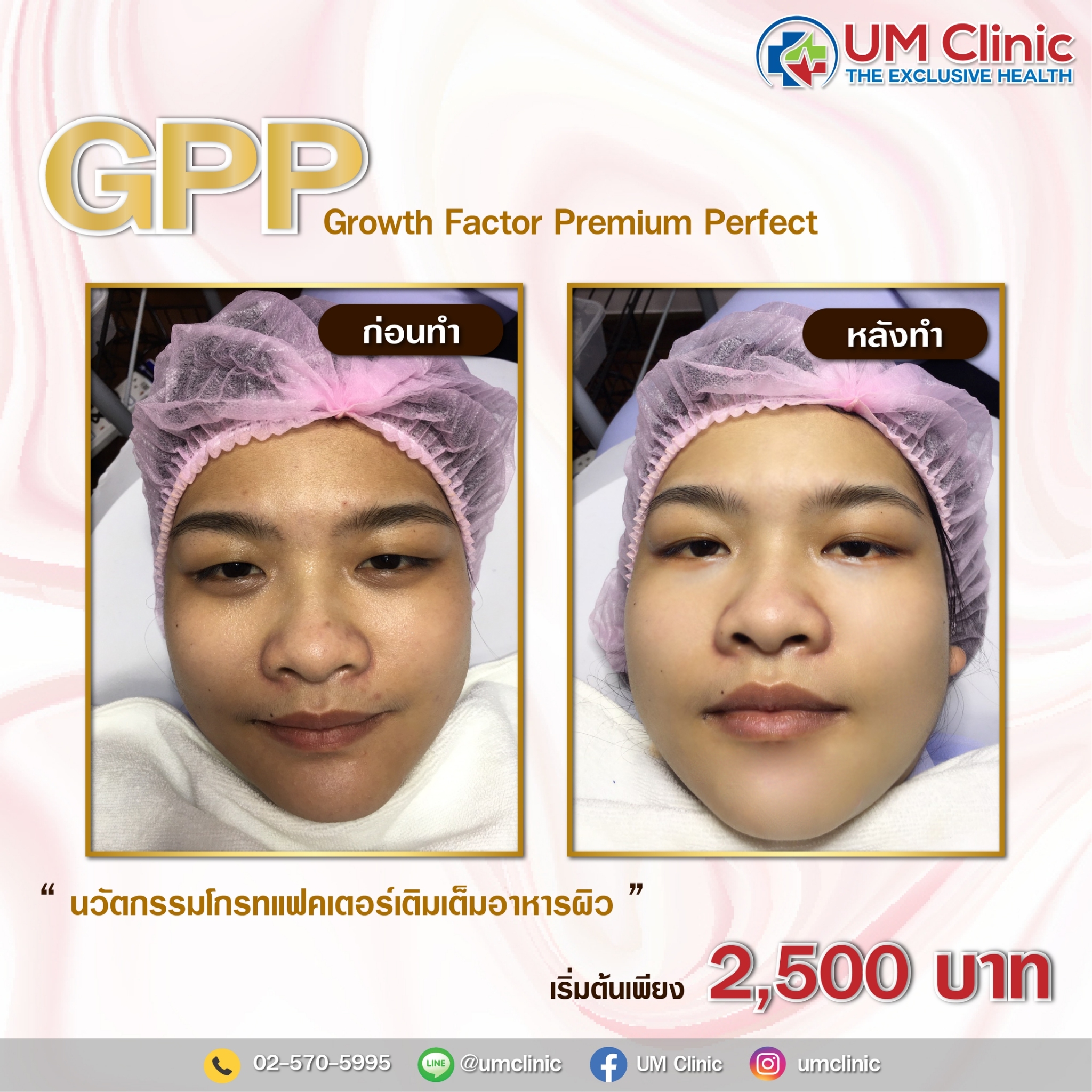 GPP_๒๑๐๓๐๑_1