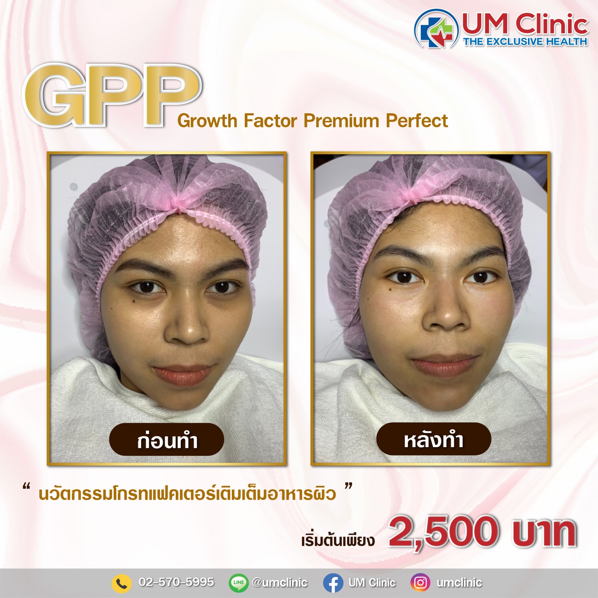 GPP_๒๑๐๓๐๑_2